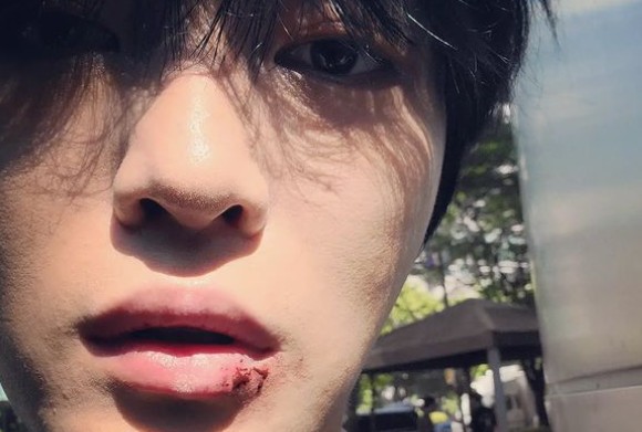 Singer Jaejoong reported the latest with a wounded lip.On the first day, Jaejoong posted two photos on his instagram with the phrase Oh, my... hurt in places.In the open photo, Jaejoong took a close selfie. Jaejoong revealed the red scars on his lips and made people sad.The netizens responded in various ways such as I am sick even if I am dressed, Is it makeup? And Is it really hurt?Meanwhile, Jaejoong released the movie On the Lorde on July 21st.On the Lorde is a documentary film about Jaejoong, who has been active as a singer and actor since his debut in the music industry in 2004, looking back on his way and looking for a new dream.
