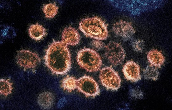 코로나19 환자에게서 분리된 세포 표면에서 관찰된 SARS-CoV-2 바이러스 입자. [미국 국립알레르기·전염병연구소]