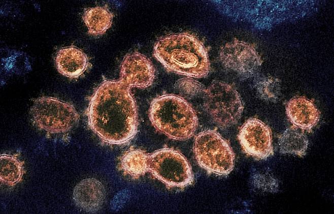 코로나19 바이러스 전자현미경 이미지 - 미국 국립 알레르기 감염병 연구소(NIAID) 제공