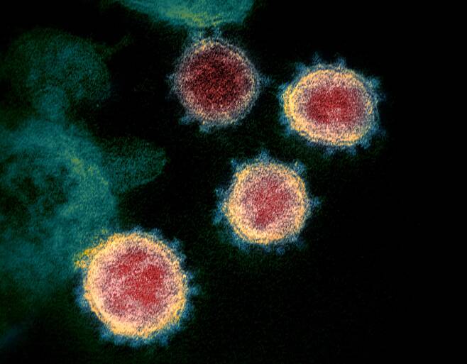 코로나 바이러스의 전자현미경 사진. 가운데 붉은 부분이 유전물질인 RNA와 이를 감싼 뉴클레오캡시드 단백질이다. /NIAID