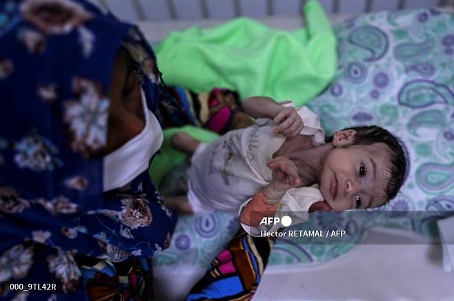 2021년 11월 22일(현지 시간) 아프가니스탄의 국경없는의사회 의료 센터에서 한 아기가 영양 실조 치료를 받고 있다./사진제공=AFP/뉴스1