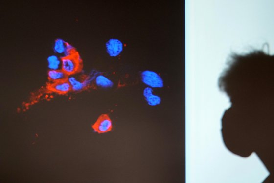 홍콩의 한 대학 연구원들이 임상표본에서 오미크론에 감염된 세포를 스크린을 통해 보여주고 있다. 연합뉴스