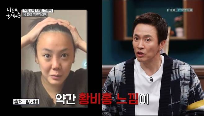 Actor Go Eun-ah has revealed he had a hair transplant following his brother Mir.On December 7, MBC Everlon Call Me, actor Go Eun-ah appeared as the eighth client.On this day, Go Eun-ah said, I had a hair transplant. At the end of MC Jang Do-yeon, My lifelong wish was all-back styling.But my house was all M-shaped, so About Her Brother (Mir) first made it the first.About Her Brother has been so invited this year that I want to be the best Choices in my life when I am 34 years old.Im so happy that (the haircut) is coming up fluttery, he confessed.