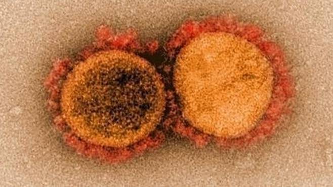 코로나19 바이러스 전자현미경 이미지  ※기사와 직접적인 관계가 없습니다. [미국 국립 알레르기 감염병 연구소(NIAID) 제공]