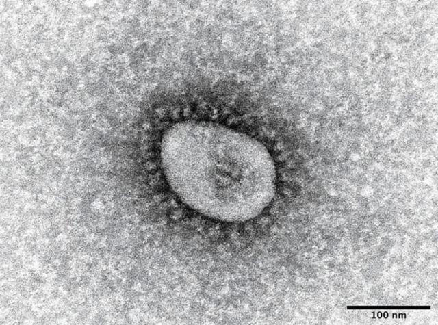 신종 코로나바이러스 감염증 오미크론 변이의 전자현미경 사진. 일본 국립감염증연구소 홈페이지