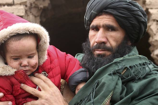 지진 피해지역의 한 아프간 남성이 18일 지진으로 얼굴을 다친 자신의 딸을 안고 있다. Abdul Raziq Saddiqi=연합뉴스