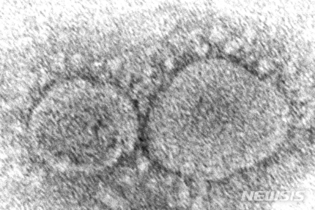 [AP/뉴시스]미국 질병통제예방센터(CDC)가 제공한 코로나19 바이러스 입자의 전자 현미경 이미지.