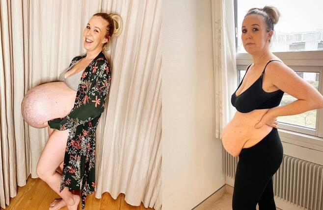 세쌍둥이 출산 전·후 사진을 공개한 미켈라 마이어 모르시. (인스타그램 갈무리) © 뉴스1