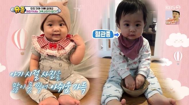 Kim Tae-kyun reveals why there are not many pictures of daughter HarinOn May 13, KBS 2TV Superman Returns, Kim Tae-kyun said he would go on a family photo trip with his daughter Harin.Kim Tae-kyun, who has no family photos, said, Harin has had a lot of hemangioma since she was a child. I want to leave her pretty, but Im sorry she couldnt take a picture.