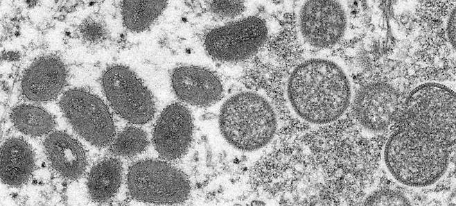 원숭이두창 바이러스는 천연두 바이러스와 같은 계통으로 증상도 비슷해 ‘천연두의 사촌’이라 불린다. CDC/신시아 S. 골드스미스