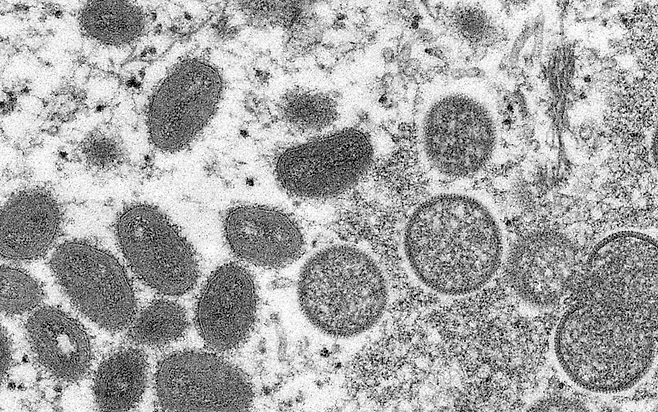 미국 CDC가 2003년 공개한 원숭이두창 바이러스 확대 모습