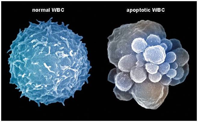 정상 세포와 사멸한 세포를 비교한 그림. 왼쪽이 정상 세포, 오른쪽이 사멸한 세포. /게티스이미지 제공