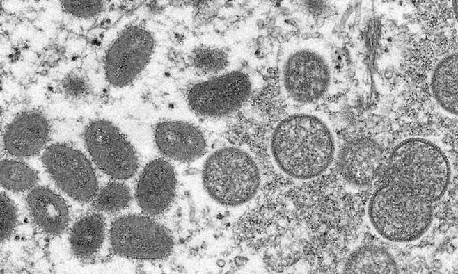 미국 질병통제예방센터가 공개한 원숭이두창 바이러스. AP뉴시스
