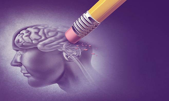 알츠하이머 환자 인지능력 저하는 과도한 철분 축적 때문 - 뇌신경과학자들은 알츠하이머 환자들의 기억력 퇴화와 인지능력 저하의 근본적 원인은 뇌 속 철분의 과도한 축적이라는 연구결과를 내놨다.픽사베이 제공