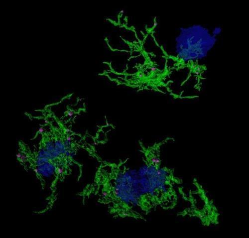 뇌에 쌓인 아밀로이드 플라크(청색)를 삼키는 소교세포(녹색)  [싱가포르 Duke-NUS 의대 제공. 재판매 및 DB 금지]