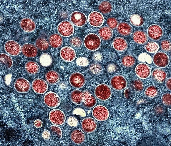 원숭이두창 바이러스 입자(붉은색) 전자현미경 이미지.[미 국립알레르기·전염병연구소(NIAID) 제공]/AP 연합뉴스