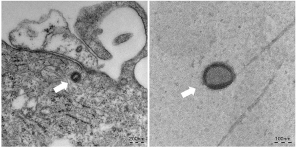원숭이두창 바이러스 전자현미경 사진. 바이러스 입자 크기는 150-200nm. [사진=질병관리청]