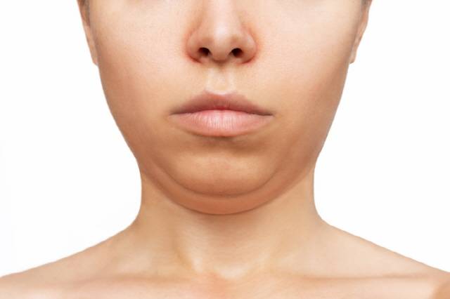 턱 근육 탄력이 떨어지면 턱살이 많아 보일 수 있다./사진=게티이미지뱅크