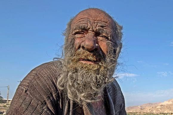 세상에서 가장 더러운 남자로 통하던 ‘아모 하지’(하지 아저씨)의 생전 모습-2018년 12월 28일(현지시간) 이란 남서부 파르스주 농촌마을 데즈가 외곽에 하지 아저씨가 앉아 있다. 2018.12.28 AFP 연합뉴스