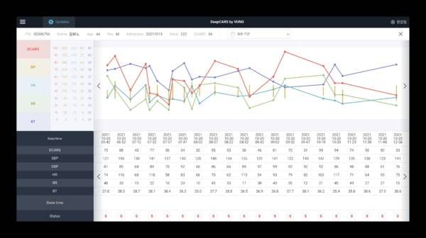 '뷰노메드 딥카스' 운영화면 예시.