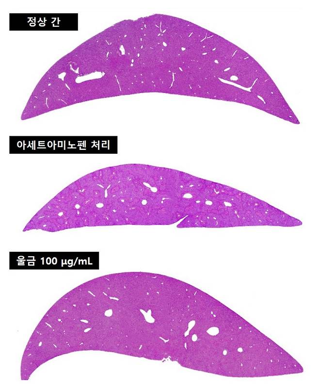 간 손상을 유발시킨 후 울금을 복용한 쥐의 간(세 번째)은 정상 간(첫 번째)에 가깝게 회복되는 모습을 보였다.