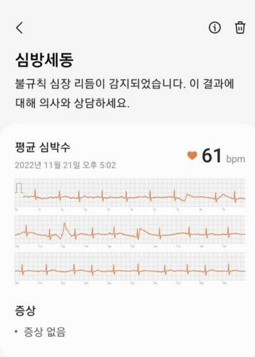 지난 5일 ‘삼성 멤버스’ 커뮤니티에 게재된 ‘갤럭시워치5’로 심박수를 측정한 결과 이미지. (사진=삼성 멤버스 커뮤니티 글 캡쳐)