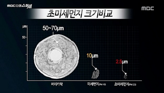 MBC ‘다큐 스페셜’ 627회 ‘미세먼지의 습격’ 캡처