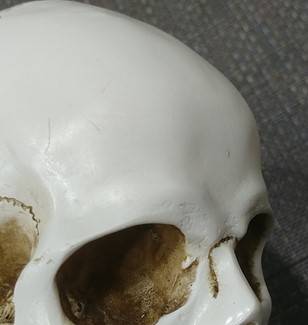 두개골을 보면 누구나 눈썹뼈는 돌출되어 있습니다. 어디까지가 이마일까요?