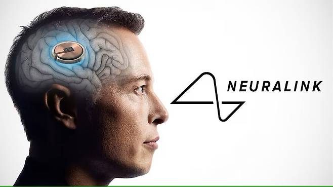 일론 머스크 테슬라 최고경영자(CEO)가 이끄는 뇌신경과학 스타트업 뉴럴링크(Neuralink)가 FDA로부터 인간의 뇌에 칩을 이식하는 임상시험에 대한 허가를 받았다./Neuralink
