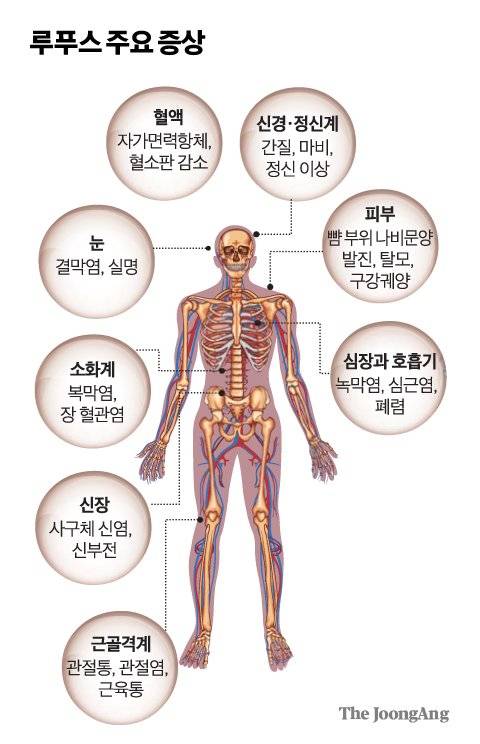 그래픽=차준홍 기자 cha.junhong@joongang.co.kr