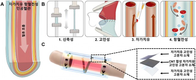 재협착을 원천적으로 차단한 인공혈관의 구조를 나타낸 모식도. 한국연구재단 제공