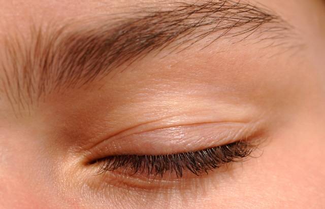 대개 속눈썹은 자극에 의해 빠지지만 질환에 의해 탈락하는 경우도 있다./사진=클립아트코리아