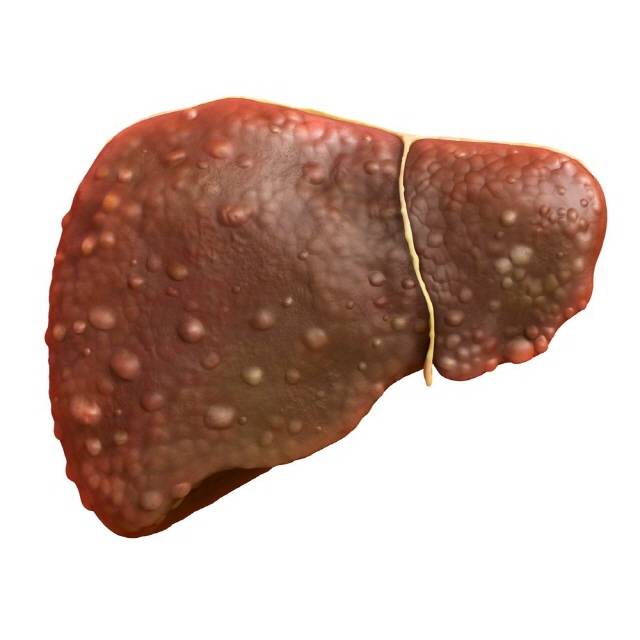 침묵의 질환인 간은 형태가 변하기 시작하는 초기엔 대부분 무증상이므로, 간을 망가뜨리는 주요 원인을 미리 파악해 고위험군이라면 제때 검진을 받는 것이 매우 중요하다./사진=클립아트코리아