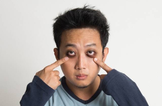 알레르기 비염으로 인해 비강의 혈액 순환이 잘되지 않으면 눈꺼풀 아래 혈류가 정체되면서 다크서클이 생길 수 있다./사진=클립아트코리아