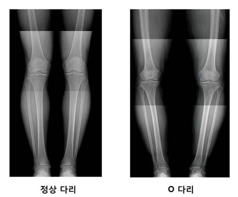 사진=헬스조선DB