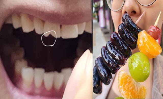 최근 치아에 손상을 줄 수 있는 음식이 유행하면서 치아 크랙이나 파절을 호소하는 이들이 늘고 있다. 상아질로 구성된 치아는 순간적인 외력에 약해 딱딱한 음식을 섭취할 때는 주의해야 한다. 김민규 기자
