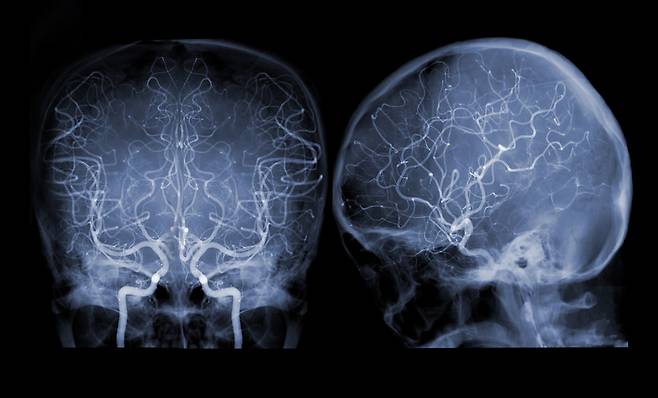 사진=클립아트코리아