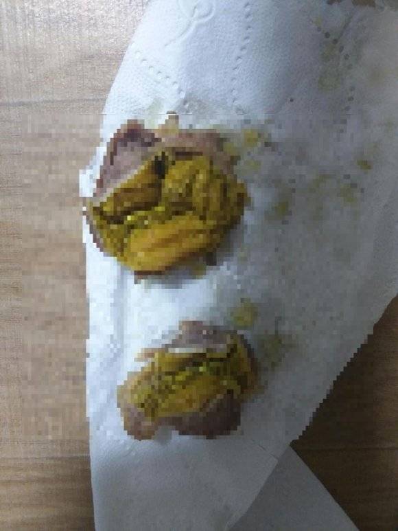 노란 이물질이 든 60계치킨 닭똥집(닭근위) 튀김. 온라인 커뮤니티