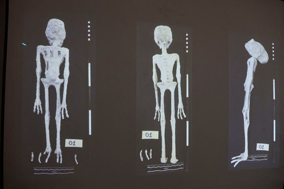 페루 법의학 연구소에서 12일 기자회견을 열고 '외계인 미라'라는 주장이 나왔던 물체의 엑스레이 사진을 띄워놓고 설명하고 있다. 로이터=연합뉴스
