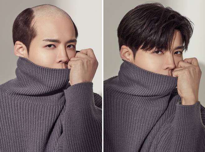 자칭 ‘가발 미남’ 최윅씨는 유튜브 채널 ‘털UP’을 통해 탈모 상담소를 운영 중이다. 최윅씨 제공