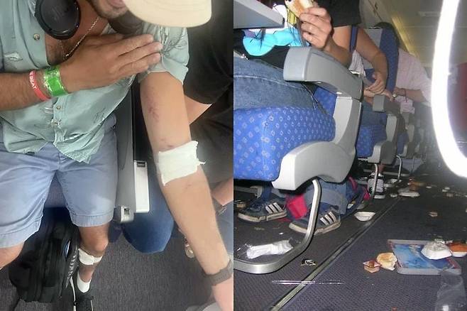 호주에서 뉴질랜드로 향하던 보잉 787기가 비행 중 기술적 문제로 급강하하면서 약 50명이 부상을 입었다. 사진은 사고 직후 다친 승객과 엉망이 된 기내 모습. /엑스(트위터)
