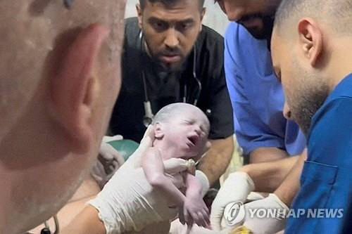 팔레스타인 가자지구 라파에서 공습으로 치명상을 입은 엄마에게서 태어난 한 아기가 응급 제왕절개 수술로 극적으로 생명을 건졌던 당시 모습을 촬영한 로이터TV 영상 캡처 /연합뉴스