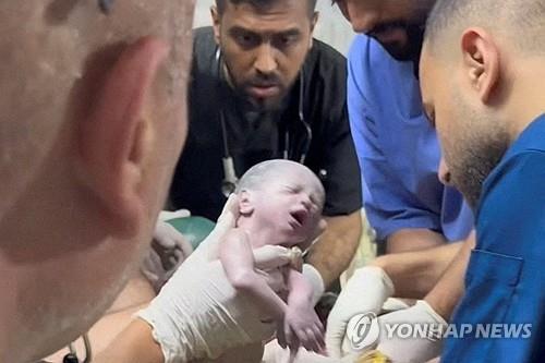 죽어가는 엄마 배 속에 있던 아기, 제왕절개로 생존 (로이터=연합뉴스) 팔레스타인 가자지구 라파에서 공습으로 치명상을 입은 엄마의 배 속에 있던 한 아기가 응급 제왕절개 수술을 통해 극적으로 생명을 건졌다. 사진은 배 속에서 막 나온 아기 모습을 촬영한 로이터TV 영상 캡처. 2024.4.21 [2024.04.22 송고]