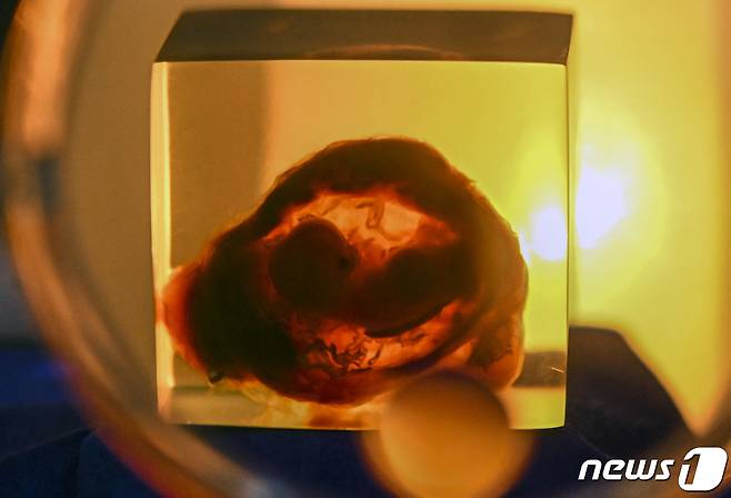 콜롬비아 보고타 인간박물관에서 유리 용기 안에 담긴 태아 모습이 전시되고 있다. 보고타 인간박물관은 과학적 관심이자 공포의 대상인 해부학 관련 전시물을 보유하고 있다. (사진은 기사 내용과 무관함) / 뉴스1 ⓒ News12022. 11. 25. ⓒ AFP=뉴스1 ⓒ News1 최서윤 기자