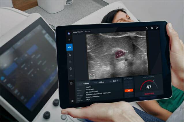 배럴아이가 개발한 정량적 초음파 진단 솔루션 화면