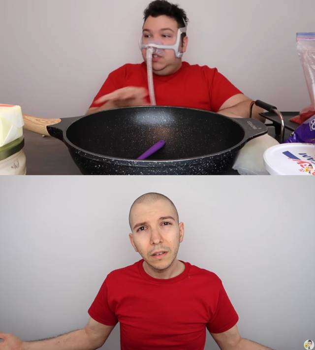 다이어트 전 산소호흡기 차고 먹방하던 니코카도 아보카도(위). 113kg 감량한 근황 공개. 사진=니코카도 아보카도 유튜브 영상 캡처