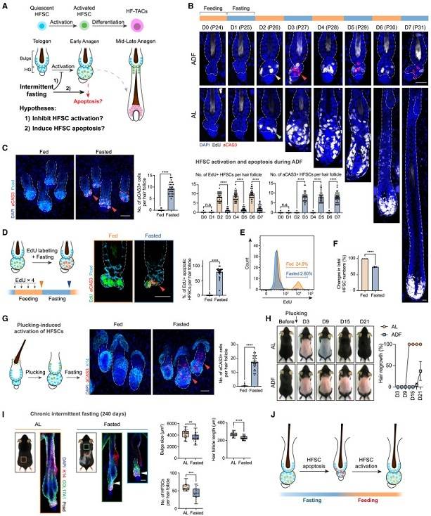 중국 서호대 연구팀의 간헐적 단식과 모발 성장 및 재생 간의 상관관계 연구. 과학저널 셀 캡처