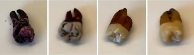 미국 캘리포니아 치과의사 마일스 매디슨 박사가 음료가 치아 착색에 주는 영향을 실험한 결과, 레드 와인, 콜라, 커피, 차 순으로 착색이 심하게 나타났다. 틱톡 갈무리.