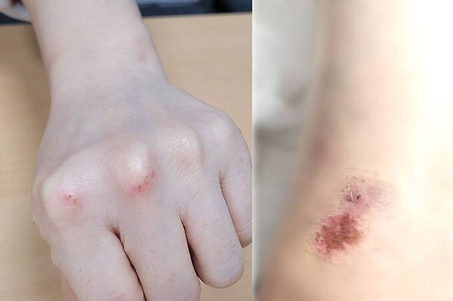 기자가 지난달 25일 오후 강남역 인근 피부과 진료 의원에 전화해 손과 무릎에 난 상처 치료가 가능한지 묻자 “쁘띠 전문 병원이라 일반진료는 안 본다”며 거절했다. 박윤희 기자