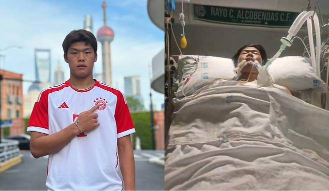 떠오르는 신예로 주목받던 중국 베이징 궈안 U19 소속 축구선수 궈자쉬안이 경기 중 상대 선수와 충돌해 뇌사 상태에 빠졌다.